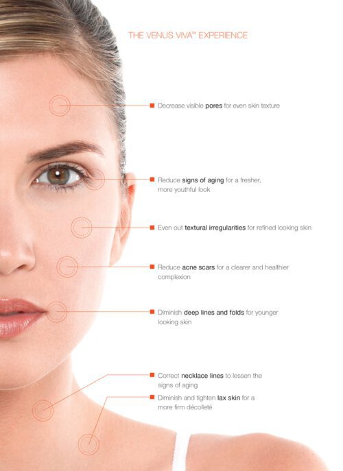 Venus Viva infographic