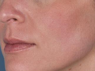 Skin Care Gallery Before & After Image