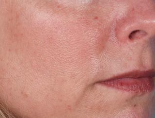 Skin Care Gallery Before & After Image