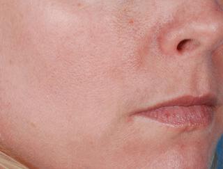 Skin Care Gallery Before & After Image